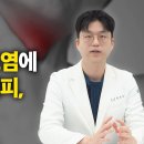 커피가 역류성 식도염 부르는 이유는? 원인부터 유형까지 ‘역류성 식도염’ 완전 정복 이미지
