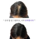 잉크본 이미지