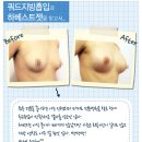 하베스트