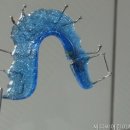 씨디씨어린이치과의원 네이버블로그