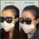 연헤어라인 티스토리