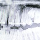 가지런이치과교정과치과의원 이미지