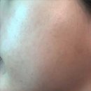 금새약국 | 약국 재생크림 피부 관리 추천 4주변화 후기