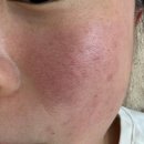 더모어 | 루원시티 홍조관리 셀토닝 내돈내산 더모어 후기