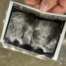 프레메디산부인과의원 이미지