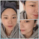 시네마의원 | [강남피부과 후기] 색소·홍조·재생까지! 레이저 오마카세 패키지 받고 왔어요 [ 시네마의원 ]