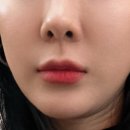 이지이샵 | 피부과 재생크림 엘라스티 포스트랩 홈쥬란 제품 가격 후기