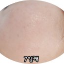 미백천사