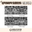 바른손치과기공소 네이버블로그