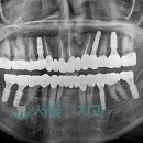 다산치과기공소 이미지