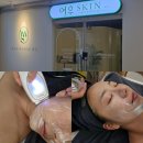 여우 | 배곧 피부샵 이중턱 두피관리 후기 여우스킨 배곧점