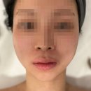 장미헤어프라자 | 대전 얼굴경락 끌리메 대전관저점 엄마선물 추천후기