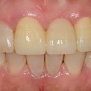 바른이치과기공소 이미지