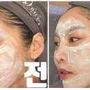 보떼헤어라인