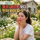 최윤정피부과의원 네이버블로그