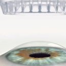 스마일 | 스마일라식 후기를 통해 살펴보는 회복과정, 기간