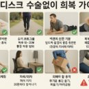 허리디스크, 수술 없이 회복한 사람들의 공통점은?