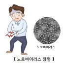 노로바이러스 장염 이미지