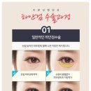 미본 이미지
