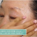 인보라