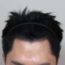 일산두피문신 잘하는곳 찾는다면? (유지기간, 가격, 리터치, 후기)