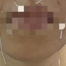 365청담한의원 | 새솔동 365청담한의원에서 턱관절치료받고온 후기