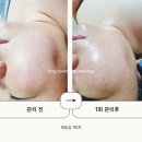 비채올테라피