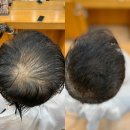 해운대에서여기까지 중년탈모 시니어탈모 머릿빨고민함께합니다 부산사상르네시떼미용실[ 금정장전대연수영망미동래초읍미남연제명륜온천광안양정거제하마 이미지