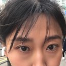 네일지나 - 부산진구 가야대로 483 | 눈밑지방재배치 다크서클 효과 가격 수술 생생 솔직 후기(통증)