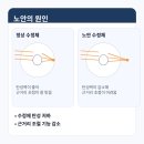 렌즈포유 이미지