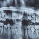 서울휴치과의원 이미지