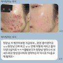 폴리프라자한대점 | 안산 피부관리샵 대신 여기까지?새솔동에서 여드름 해결한 후기