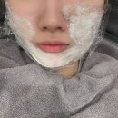 웨딩관리 / 인천 논현수의원 슈링크&보톡스 후기(내돈내산)