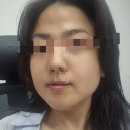 스킨지키미 | [서울/신사역] 강남 피부과 추천 레티젠 스킨부스터 솔직 후기