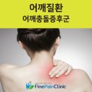 어깨충돌증후군 비수술치료 강북정형외과!! 이미지