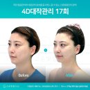스마트에스테틱