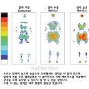 허리디스크 초기 천연라텍스 매트리스가 도움이 될까요? 이미지