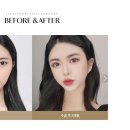 리엔장성형외과의원 네이버블로그