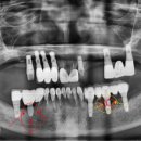 라인플란트치과의원 이미지