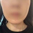 디그데이터 | [디그니파이]강사가 직접 해본 셀프 임상 이어테라피 리프팅 (결과확인) | 왜 턱선이 살아날까요? 정답...