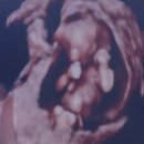양수1여자 | 청주 하안유산부인과 최용석 원장님 임신 초기 출혈, 양수터짐 입원 후기 (10주, 12주 검사)