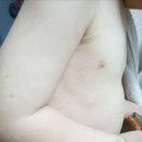 백옥화 | [아토피 피부 탈출기] 보타랩 슈아멜 바디워시/스크럽/크림 8주 사용 인증 후기