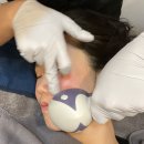 튠스타트 | 부산튠페이스효과 팔자주름 내돈내산 2회차 후기
