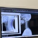 모가지 | 모가지 사형선고 feat. 목디스크, 병원 후기