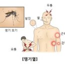 뎅기열이라고 아시나요? 지금 동남아에 뎅기열 확산!! 이미지