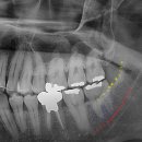 호평나무치과의원 이미지