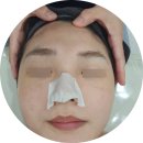 바이오 마스터 | 수지구청 피부관리 문제성 피부 전문 여드름 관리 전문 마스터더뷰티 바이오폭스 관리 후기