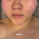 [초량] 맞춤형 피부관리 전문 에스테틱 내돈내산 관리 찐 후기 - 초량 리안뷰티🧖🏻‍♀️