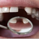 더밝은치과의원 이미지