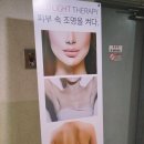 몽드로쉐 이미지